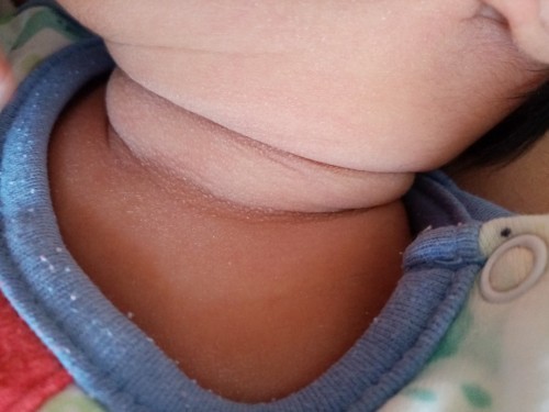 ขอคำแนะนำ