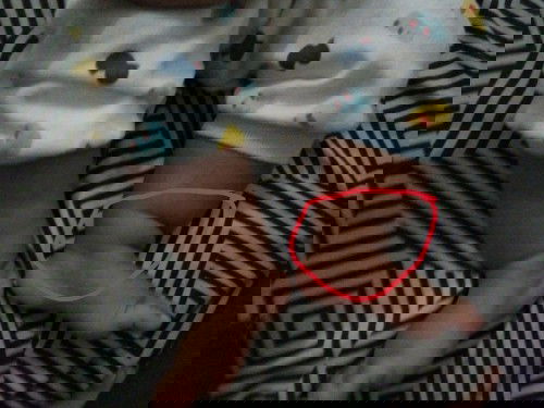 Kaki bayi tidak sama