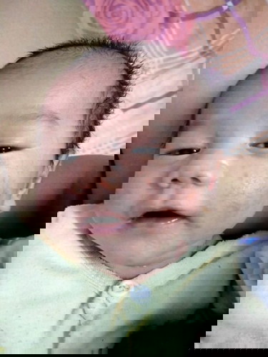 ผื่นแดง พอลูบแล้วรู้สึกสากๆ