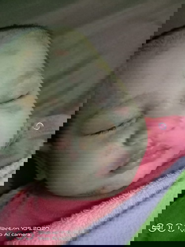 แพ้นมวัวบ้านไหนเป็นบ้าง