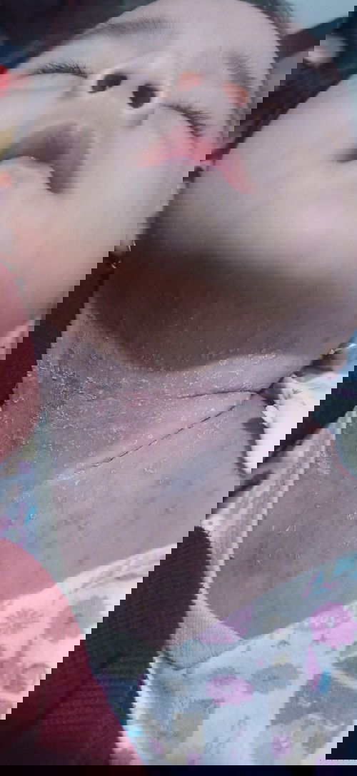 tak kunjunhlg sembuh