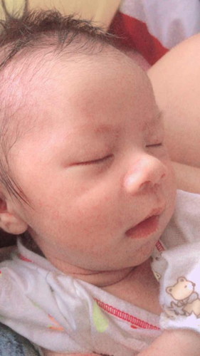 โกนผมไฟ ขอคำแนะนำจ้า แม่ๆค่ะ