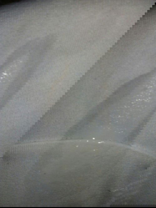 Is this normal discharge?