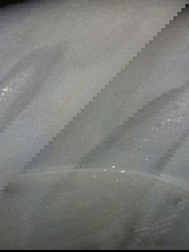 Is this normal discharge?