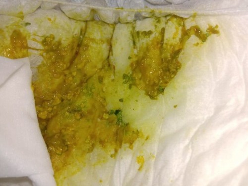 Kulay nang poops ni LO