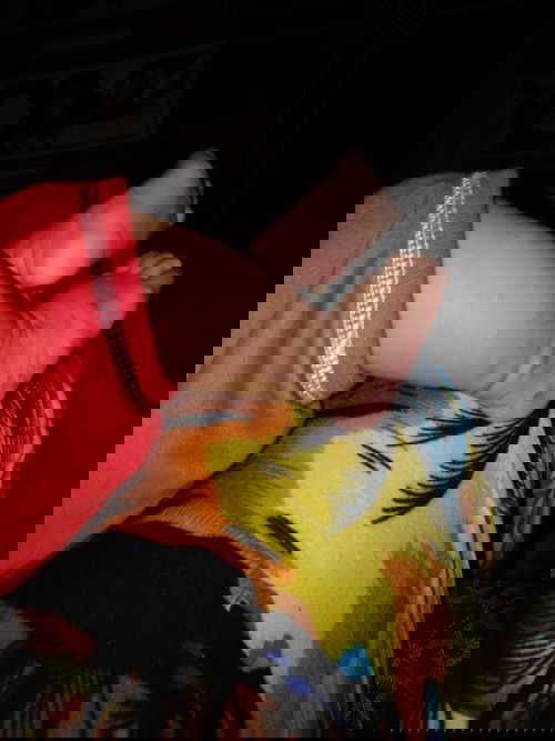 Gatal-gatal atw alergi