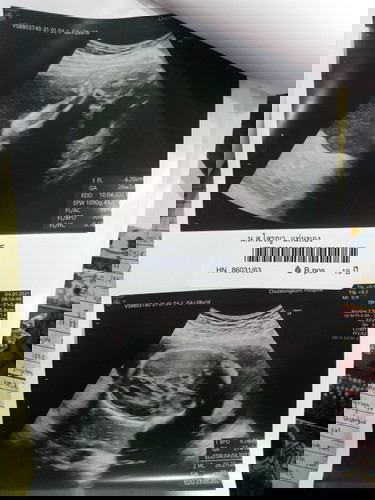 อวดรูปอัลตร้าซาวน์กัน🥰