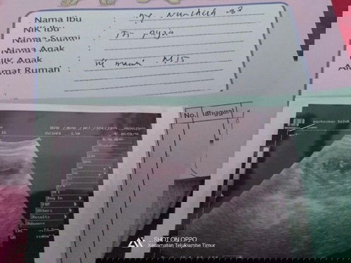 Ini hasil USG saya . 
Usia kehamilan 12 Minggu.
Hpl 20 Juli 2021
Semoga sehat selalu . Amin