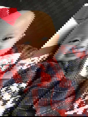 น้องตาบวมฝั้งซ้ายของรูป แบบนี้อันตรายมั้ยคะ น้องไม่มีอาการอะไรเลยค่ะ มีแค่ตาบวมขึ้น