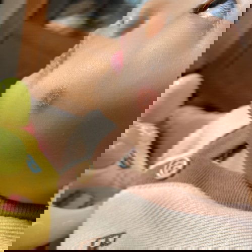 แผลที่ใบหน้าของน้อง