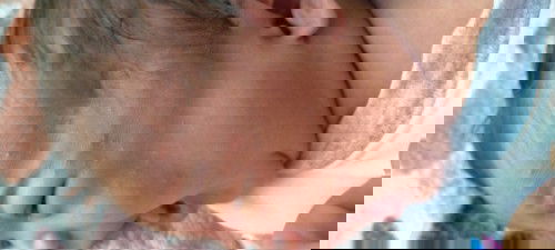 ลูกมีผดแดงเต็มหน้า