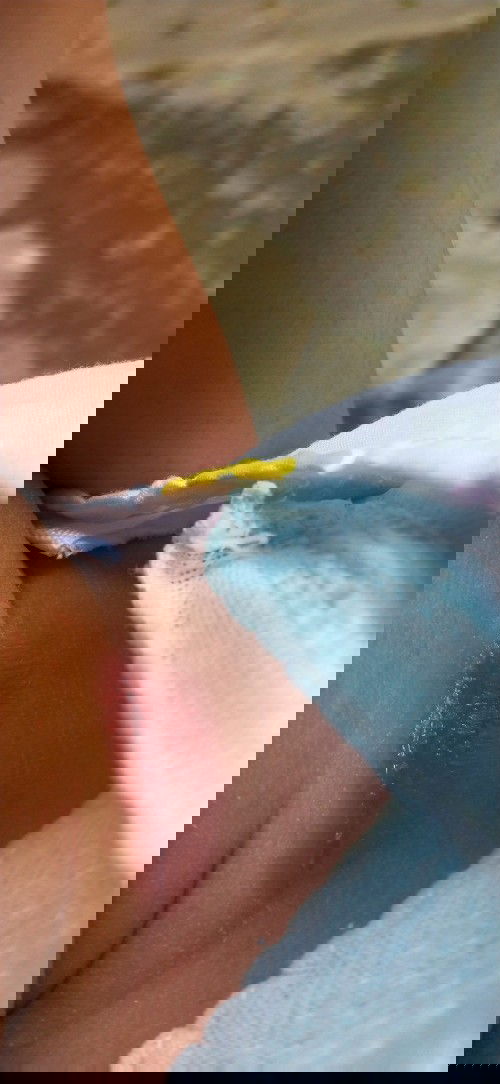 Lecet terus, saran harus pake cream apa yang ampuh.