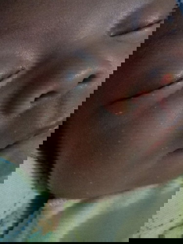 Cara ngilangin bintik putih