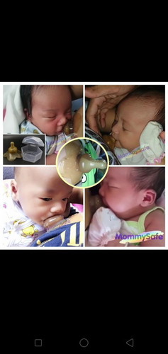 จุกซิลิโคนครอบหัวนม