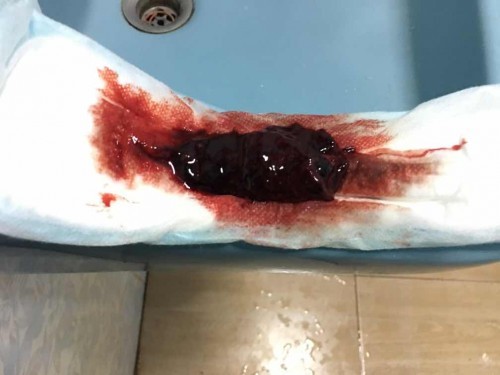 แบบนี้อันตรายไหม