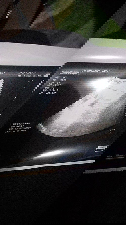 Kandunganku d nyatakan nyaris keguguran ☹