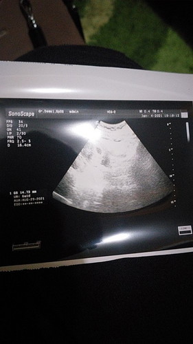 Kandunganku d nyatakan nyaris keguguran ☹