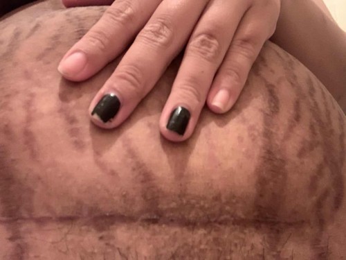 ผ่าท้องคลอด😑😑😑