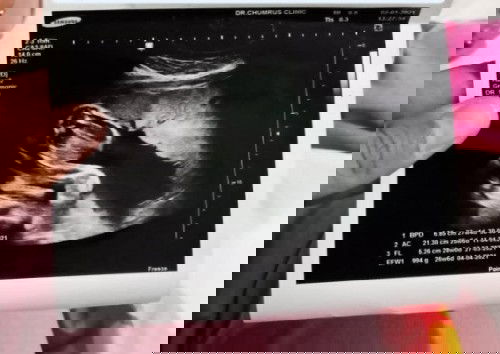 แบบนี้ผู้หญิงหรือผู้ชายคะ