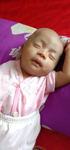 ObT sariawan buat bayi 2 bulan ap ya bunda..
