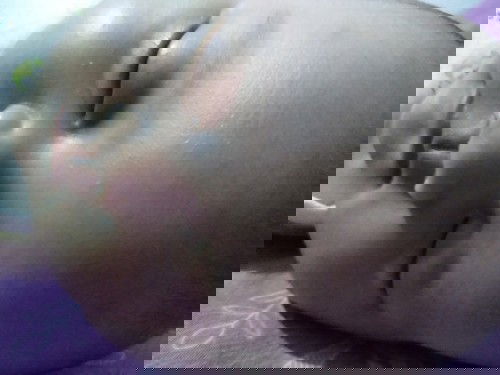 Muka bayi 3 bulan bruntusan