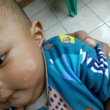 bercak putih