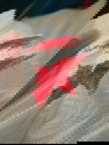 เลือดออกหลังคลอด