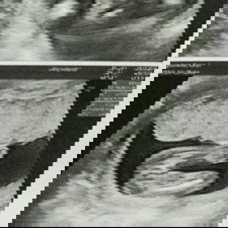 ท้องแรกค่ะ