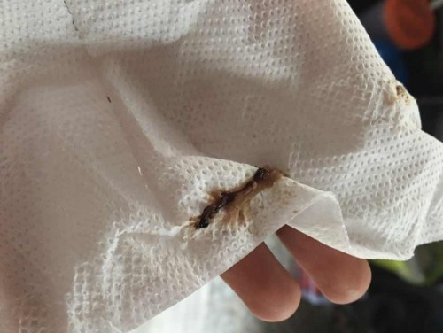 แบบนี้ใกล้คลอดหรือยังคะ