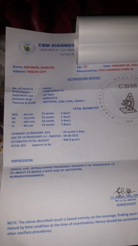 C-section or normal delivery?