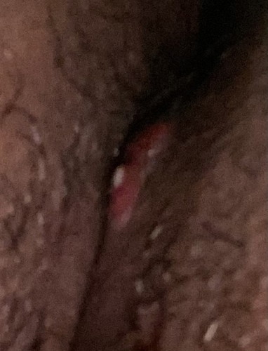 pahelp naman po about Tahi (NSD)