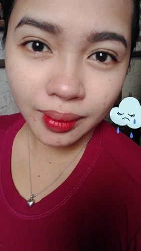 Madami ba kayong pimples?