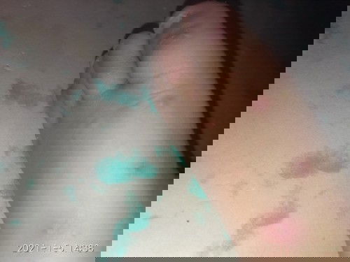 Bunda sekalian, tau gak ini penyakit apa ya ?