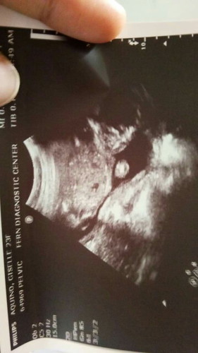 Ano po kaya gender ng baby ko?