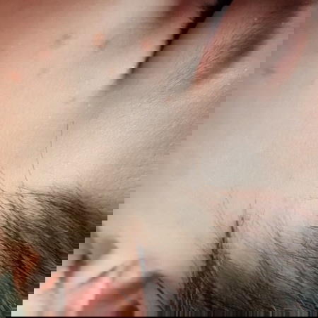 Baby has red bumps on cheek