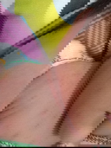 Kalau biang keringat pakai apa y yg ampuh kadang kayak melenting putih gitu