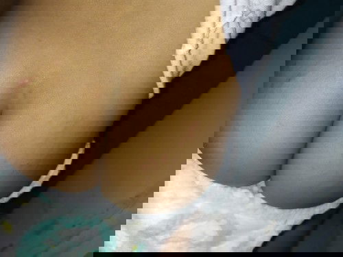 Kulit baby umur 21 bulan