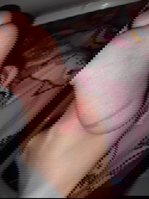 Telapak kaki bayi 11 bulan merah tetapi tidak bendol