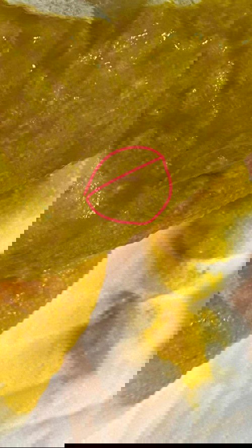 Tia máu trong phân bé 3 tháng