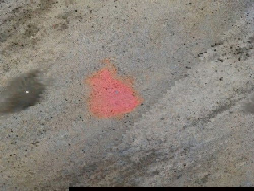 Normal lang po ito ??