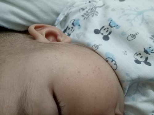 Kulit muka kering