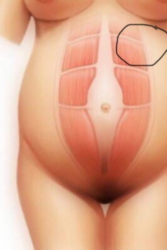 แสบชาบริเวณท้อง