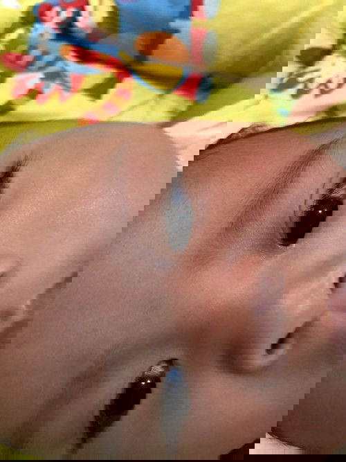 Red spot sa eye ni l.o