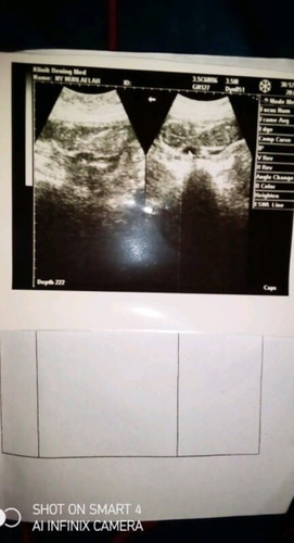 Assalamualaikum bunda mau tanya klo usia kehamilan 16w plasenta nya menutup harus gmna bun