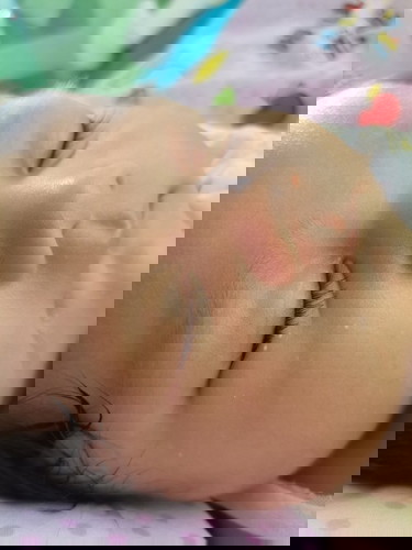 Butlig na puti sa face ni baby