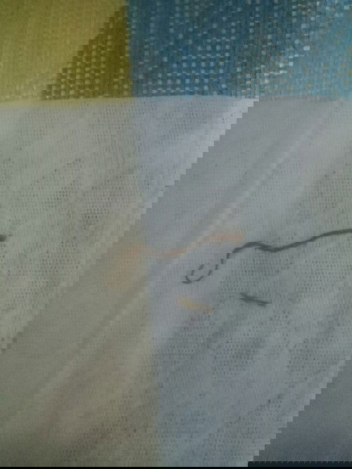 Turning 2mnths na c lo ko dis jan 16.pero mahapdi parin ung tahi ko,.nahi2rapan aq umihi kc pg nada2