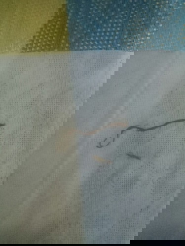 Turning 2mnths na c lo ko dis jan 16.pero mahapdi parin ung tahi ko,.nahi2rapan aq umihi kc pg nada2