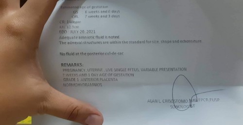 Hello meron ba dito nakakabasa kung ano nakasulat dito. Nag ultra sound kasi ako. Slamat po