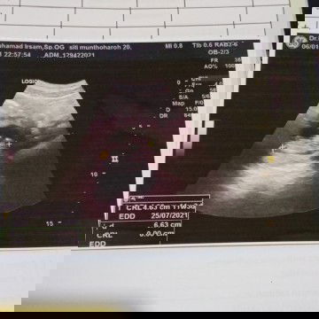 Hasil usg pertama kali