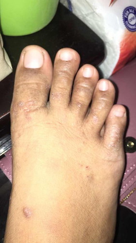 Helpme☹️ gatal menyiksaku